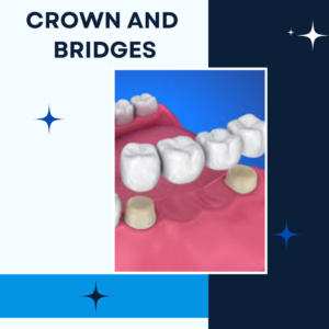 crown bridges treatment