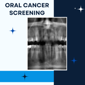 oral cancer screening