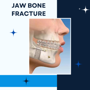 jaw bone fracture surgeries at bhuj