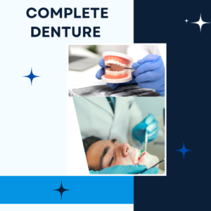 complete dentures treatment