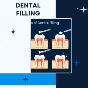 dental fillings treatment