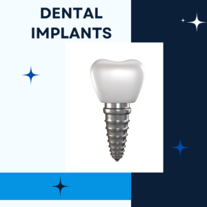 dental implants treatment