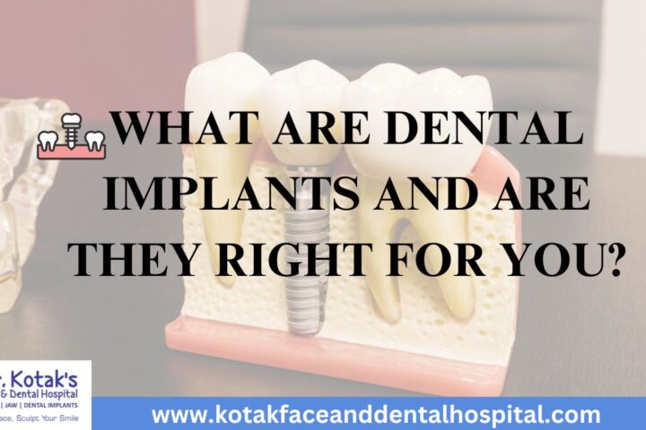 Illustration showing dental implants, including the implant post, abutment, and crown, with a focus on how they restore missing teeth at Dr. Kotak’s Face and Dental Hospital