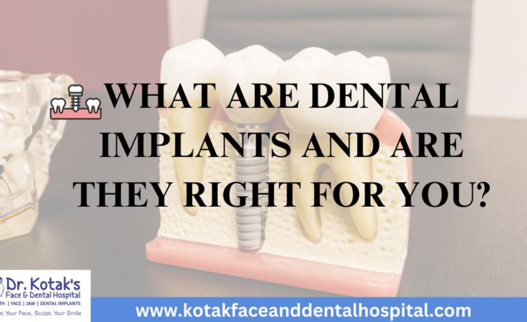 Illustration showing dental implants, including the implant post, abutment, and crown, with a focus on how they restore missing teeth at Dr. Kotak’s Face and Dental Hospital
