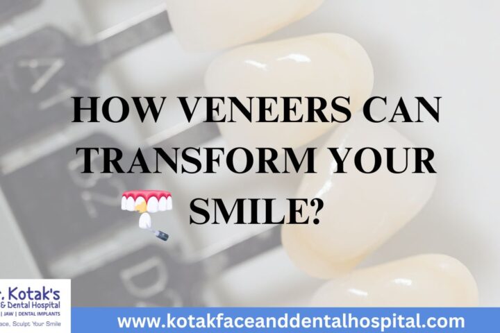 efore and after images showing how dental veneers can transform a smile by correcting stains, chips, and misalignment at Dr. Kotak’s Face and Dental Hospital."