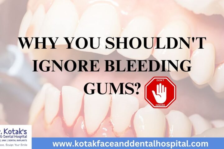 Image showing red, inflamed gums with a warning about the importance of not ignoring bleeding gums and seeking care at Dr. Kotak’s Face and Dental Hospital.